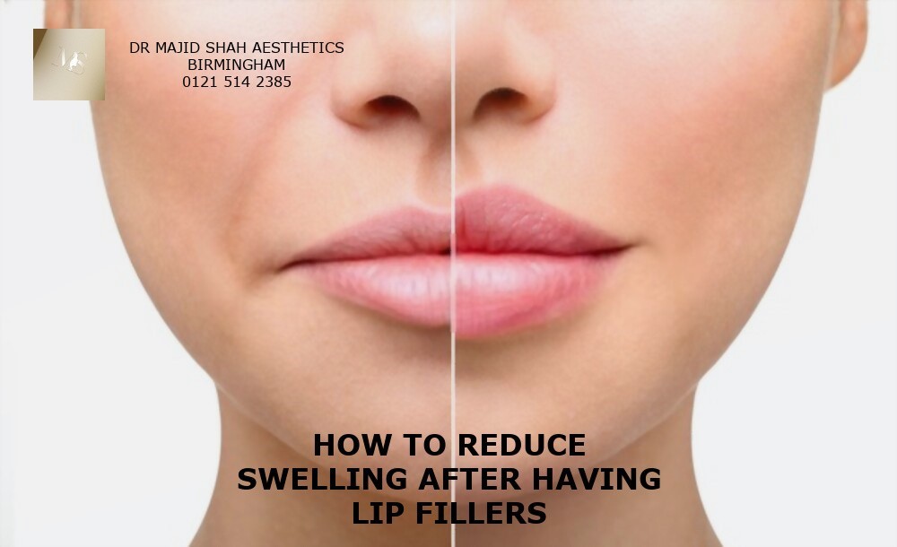 Lip Filler Swelling Stages | Bruising Lip Injections | Dr Majid Shah