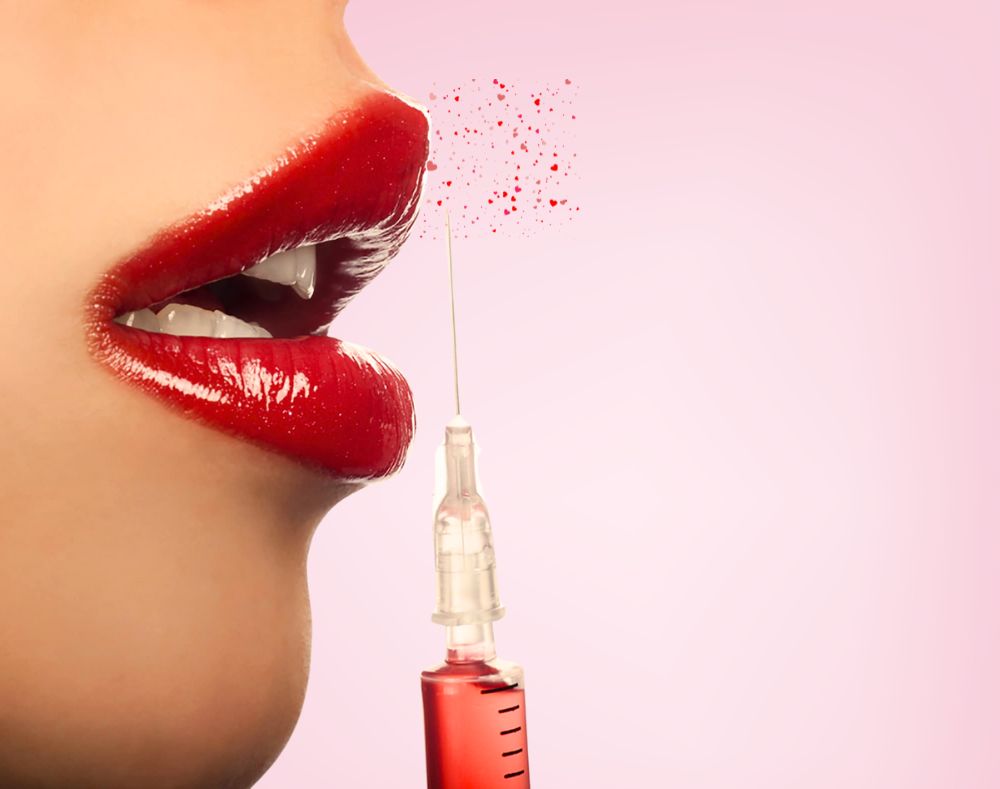 What Is Russian Lip Filler | Dr Majid Shah Aesthetics