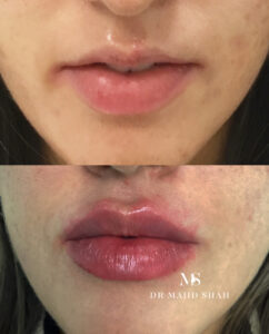 paper lip