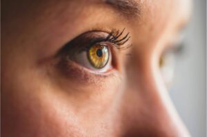 heavy eyebrows after botox treat