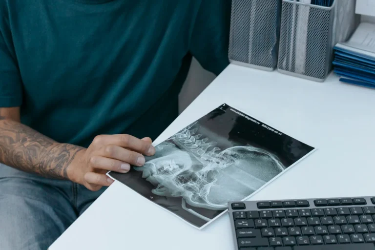 dr looking at xray picture related to tmj